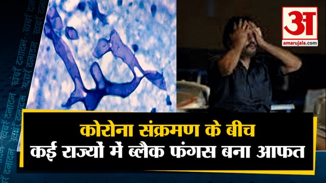 Corona के बीच Gujarat-Punjab समेत देश के कई राज्यों में बढ़ा Black Fungus का प्रकोप |10 Big News