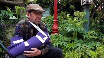 Firework victim recovering at home