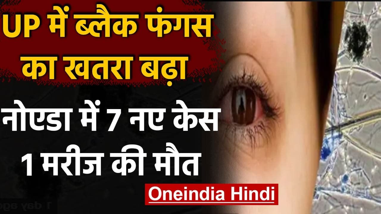 Black Fungus: UP में ब्लैक फंगस का खतरा, Noida में 7 नए मरीज, एक की मौत | वनइंडिया हिंदी