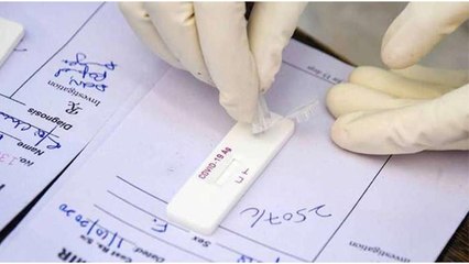 Corona Virus है या नहीं Feluda Test से चलेगा मिनटों में पता, RT PCR से कितना बेहतर | Boldsky