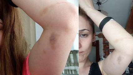 Kızlarının önünde patronu darp etti