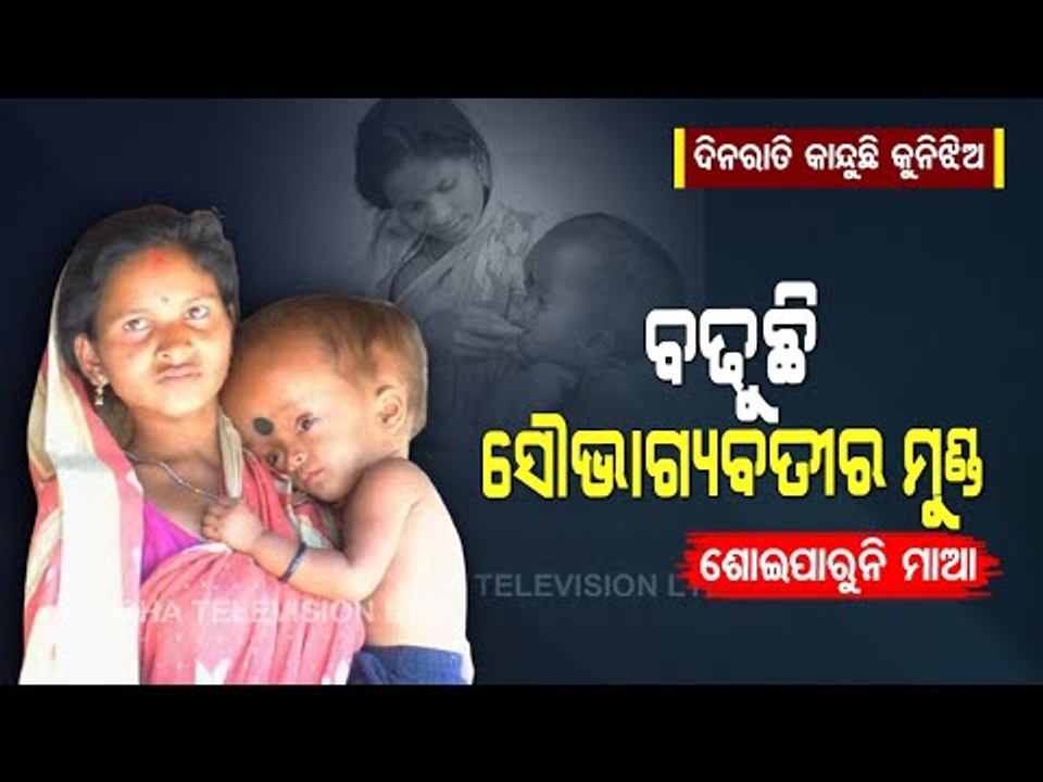 Special Story | Baby With Abnormal Head Growth Awaits Govt Aid