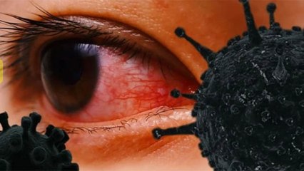 Black Fungus Infection : भूलकर भी न करें ऐसी गलतियां, जानें बचाव के उपाय? । Boldsky