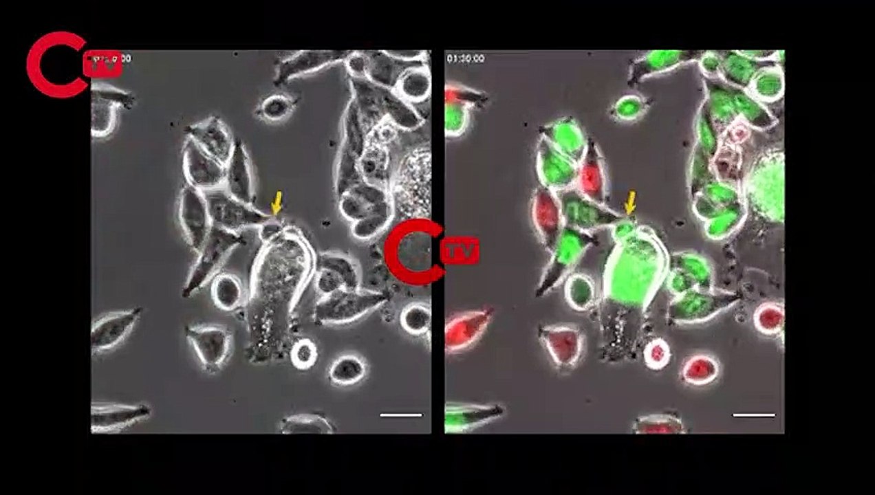 KANSER ALANINDA YENİ BULUŞ