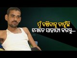 Special Story | Jajpur Man With Abdominal Tumor Seeks Help