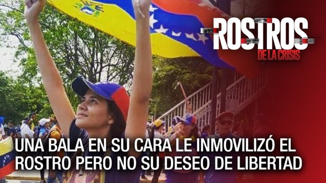 Una bala en su cara le inmovilizó el rostro pero no su deseo de libertad - Rostros de la Crisis