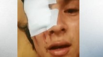 Joven resultó lesionado en su ojo por tanqueta del Esmad en Popayán