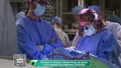 Homem X macaco- Game Pong vai servir como desafio de implantes cerebrais