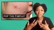 Dermatologists debunk 12 acne myths