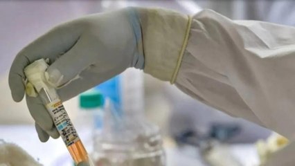 Here's what expert said on plasma therapy confusion