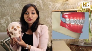 What is Genioplasty or Chin Surgery? Dr Sanchaita Kohli - Oral and Maxillofacial Surgeon