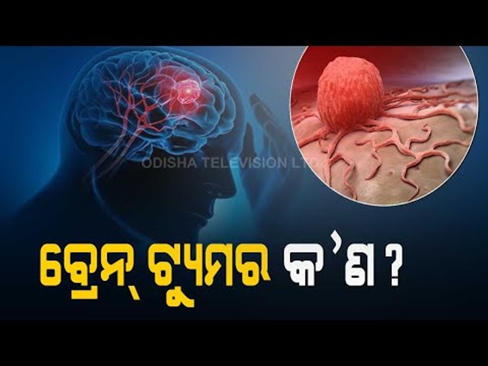 Doctor Doctor | Symptoms & Treatment Of Brain Tumour