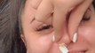 Esthetician's Fake Nail Gets Stuck in Woman's Nose After Failed Attempt at Nose Waxing