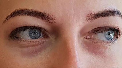 पलकों के ऊपर सूजन क्यों होती है | पलकों के ऊपर सूजन का कारण | Boldsky #Health