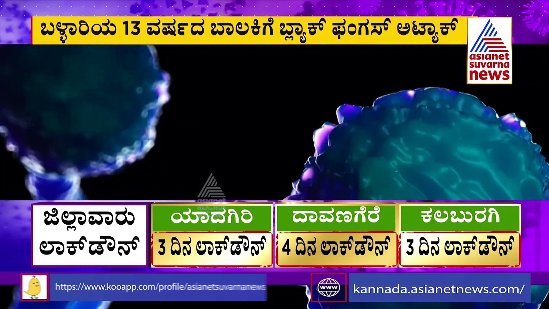 13 ವರ್ಷದ ಮಗುವಿಗೂ ಬ್ಲ್ಯಾಕ್ ಫಂಗಸ್ ಅಟ್ಯಾಕ್, ಕೊರೋನಾ ಬಂದಿದ್ದೇ ಗೊತ್ತಿಲ್ಲ