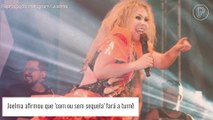 Joelma comenta inchaço no rosto durante show no Rio: 'Com ou sem sequela, vim fazer a turnê'