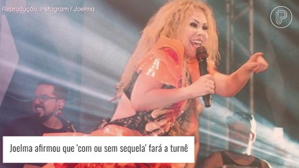 Joelma comenta inchaço no rosto durante show no Rio: 'Com ou sem sequela, vim fazer a turnê'