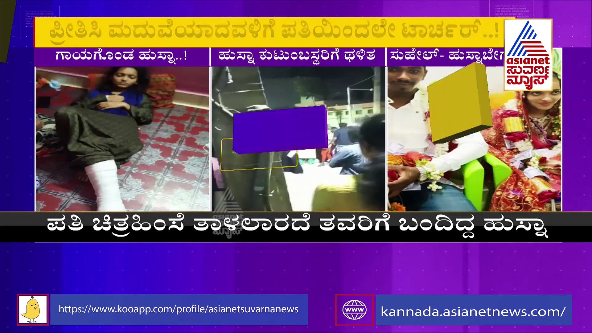 Bengaluru:ಲವ್ ಮ್ಯಾರೇಜ್, ವರದಕ್ಷಿಣೆ ಕಿರುಕುಳ, ಮನಬಂದಂತೆ ಥಳಿಸಿದ ಪತಿ