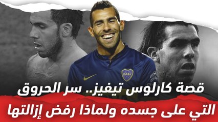 قصة كارلوس تيفيز..  سر الحروق التي على جسده ولماذا رفض إزالتها