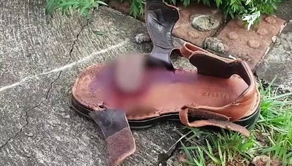 Colisão entre motocicletas deixa três pessoas feridas; homem teve três dedos amputados
