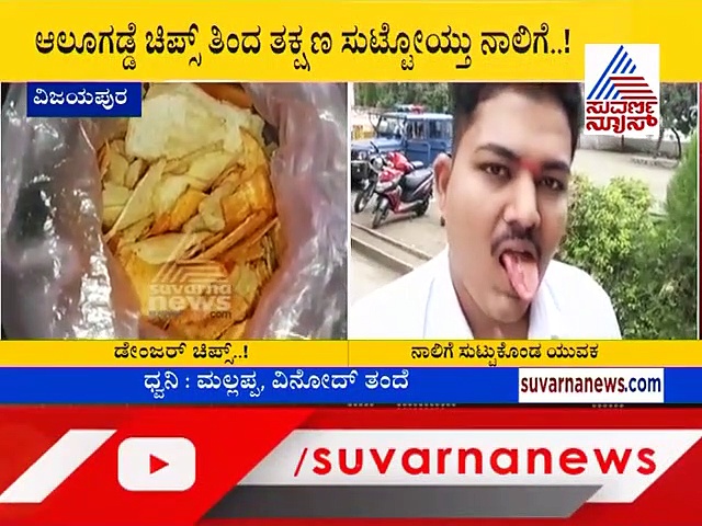 ಟೇಸ್ಟಿ ಚಿಪ್ಸ್ ಎಂದು ತಿಂದವನ ನಾಲಿಗೆಯೇ ಸುಟ್ಟೋಯ್ತು!