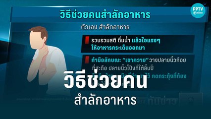 แพทย์แนะวิธีช่วยคนสำลักอาหารที่ถูกต้อง | เที่ยงทันข่าว | 7 มิ.ย. 65