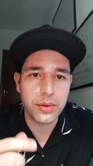Coxinha explode e causa queimadura no rosto de Pr. Lucas