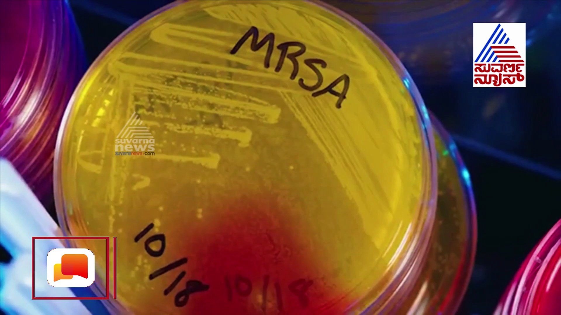 ಕೊರೊನಾ ತಡೆಗಟ್ಟಲು ರೆಡಿಯಾಗಿದೆ ಕಂಡು ಕೇಳರಿಯದ ಟೆಕ್ನಿಕ್