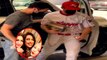 Priyanka Chopra के पति Nick Jonas को लगी बुरी तरह चोट, लंगड़ाने का Video हुआ viral |*Bollywood