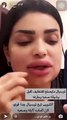السعودية أودي الزبن تكشف عن تعرضها للتشويه بسبب ابرة تذويب.. فيديو صادم