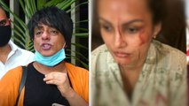 Nisha Rawal की चोट देखकर कांप उठे Rohit Verma, Karan Mehra को बताया हैवान | FilmiBeat