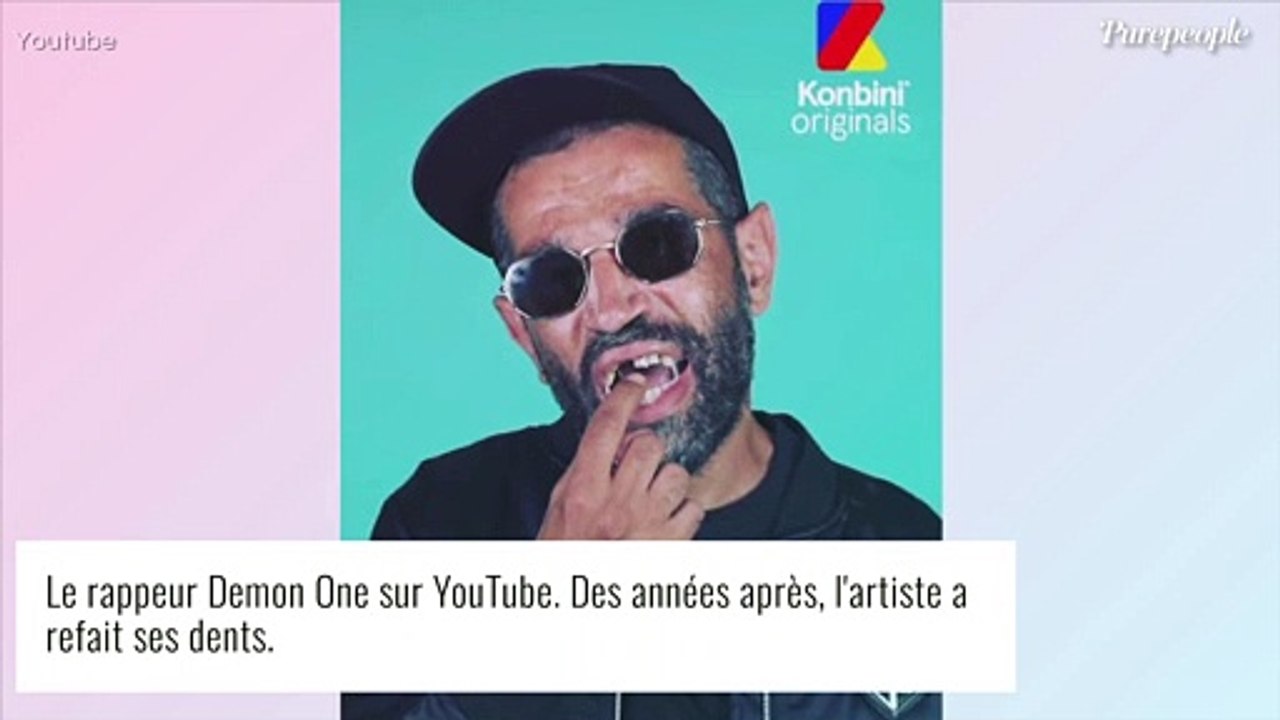 Demon One métamorphosé : le rappeur a refait ses dents et dévoile le ...