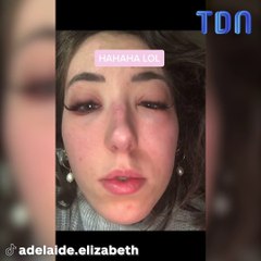 Cette femme a vu son visage complètement se déformer après avoir fait une extension de cils !