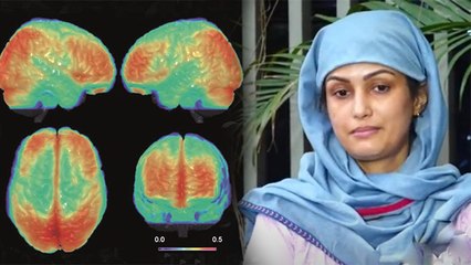 Nisha Rawal को है Bipolar Disorder, जानें Symptoms and Cause | Boldsky