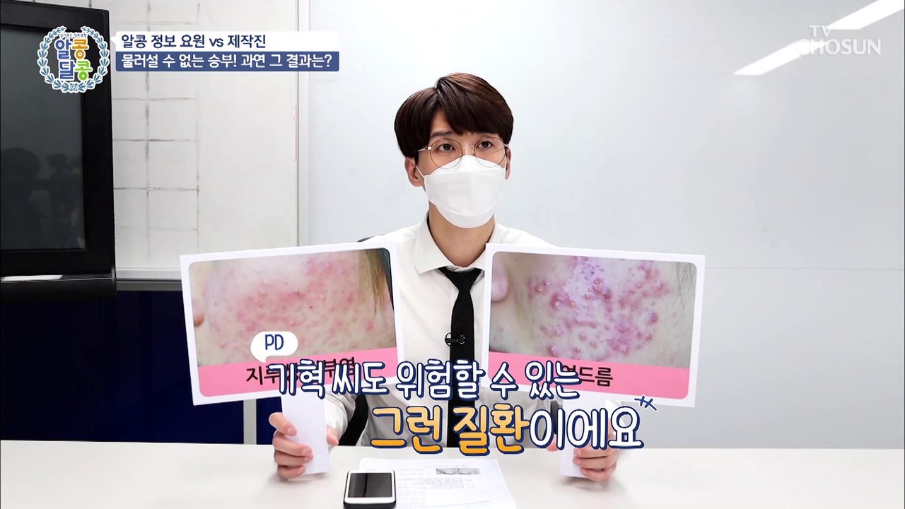 두피 피부를 망가트려 탈모를 부르는 ❛지루성 피부염❜ TV CHOSUN 2021060...