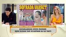 Canlı yayına bağlanan kadın, eşinin kendisini kızgın yağ ile yaktığını söyledi