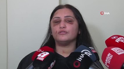 Sokak ortasında kızının gözleri önünde eski eşini darp eden kocaya 10 yıl 4 ay hapis