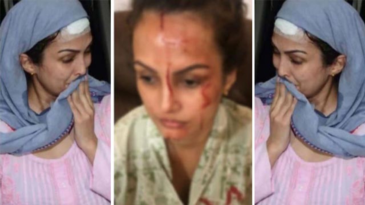 Karan Mehra ने  Nisha Rawal को दी चोट तो हुई surgery; अब ऐसी है Nisha की हालत | FilmiBeat