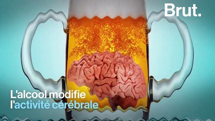 Que se passe-t-il dans notre cerveau lorsqu'on est en gueule de bois ?