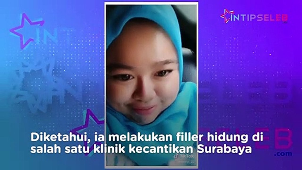 Wajah Kekeyi Bikin Pangling Usai Lakukan Filler Hidung