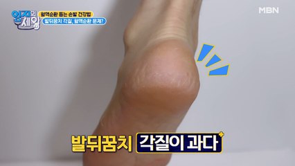 발뒤꿈치 각질 많은 사람 ※집중※ 발뒤꿈치 각질, 혈액순환 때문?!
