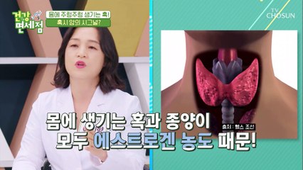갱년기 여성의 혹과 용종!! Hoxy.. 암 일까요? TV CHOSUN 20210606 방송
