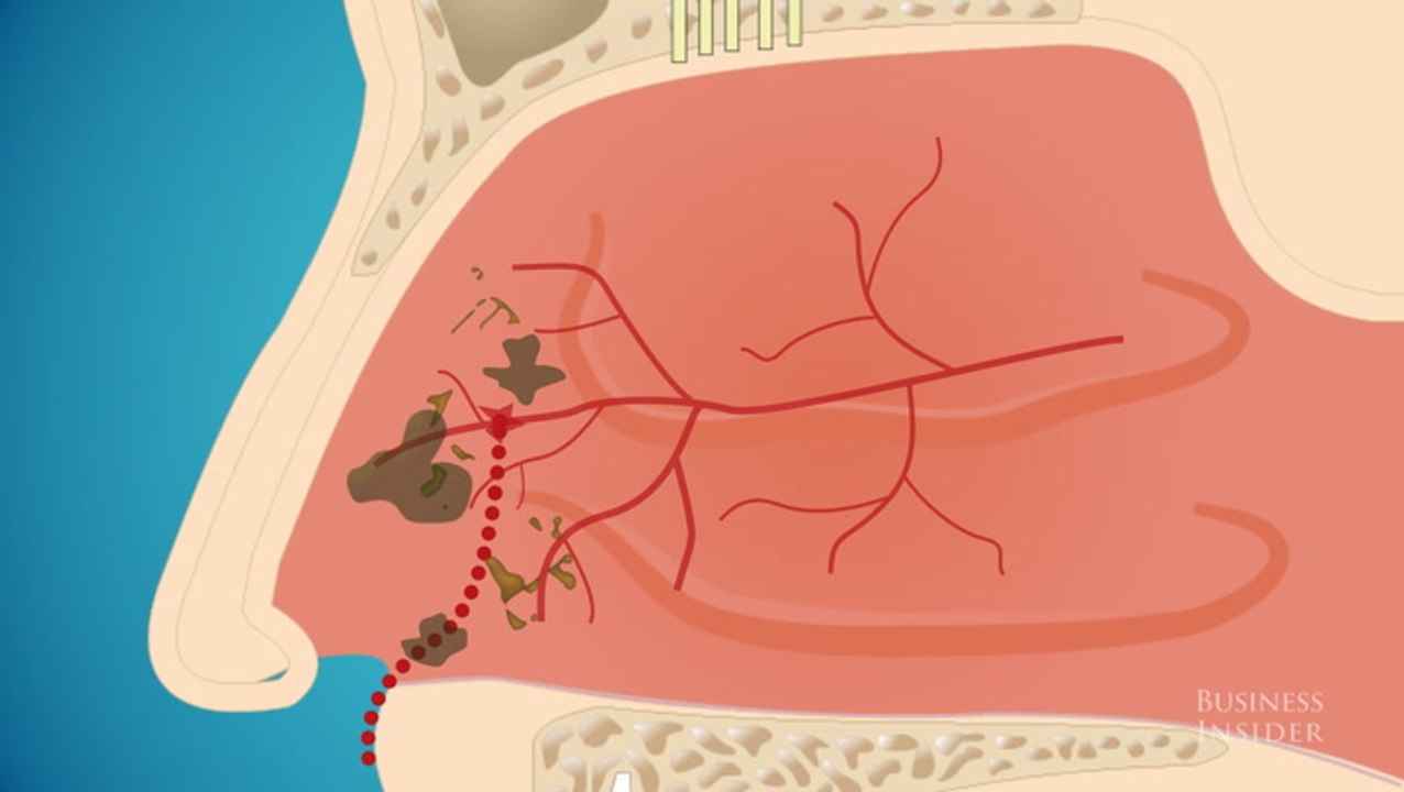 Why you shouldn't eat your boogers video Dailymotion