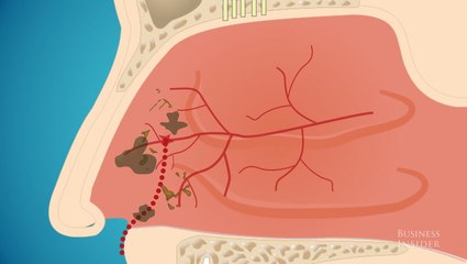 Why you shouldn't eat your boogers