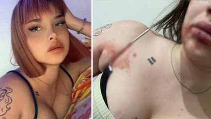 Tayt giydiği için sevgilisinin darp ettiği fenomenden garip açıklama: Bunu bekliyordum