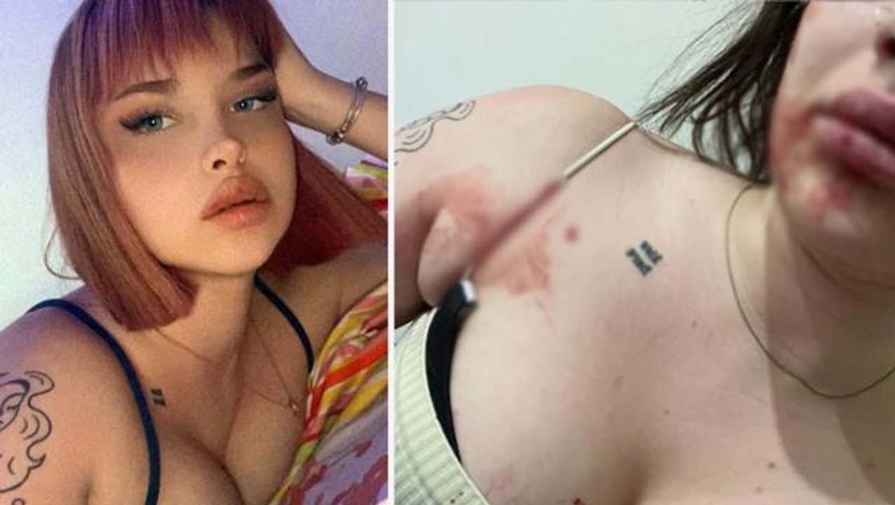 Tayt giydiği için sevgilisinin darp ettiği fenomenden garip açıklama: Bunu bekliyordum