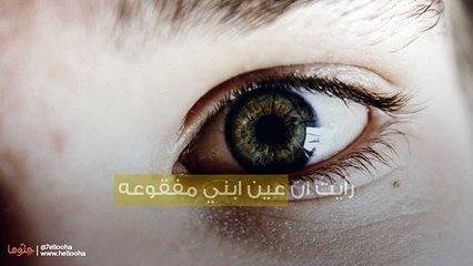 رأيت ان عين ابني مفقوعه