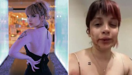 Sosyal medya fenomeni kız arkadaşını tayt giydiği için darbeden oyuncu, serbest bırakıldı