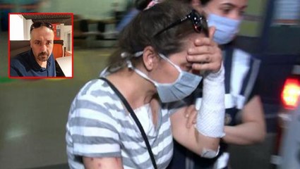 Erkek arkadaşını yüzüne kezzap attı, tahliye edildi