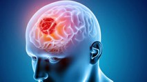 World Brain Tumor day : नींद और ट्यूमर के बीच है गहरा कनेक्शन